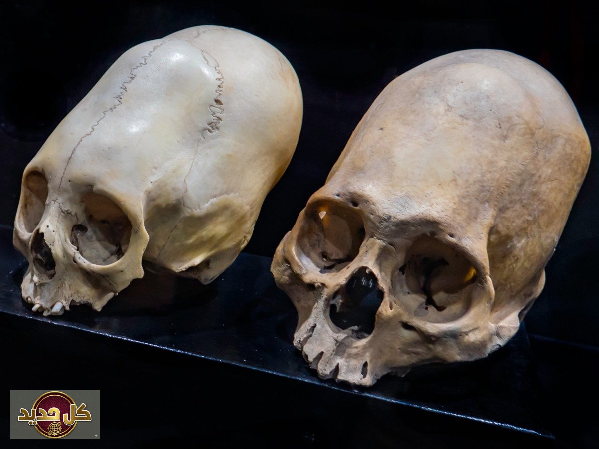 تعديل شكل الجمجمة: كشف لغز الجماجم المستطيلة عبر آلاف السنين