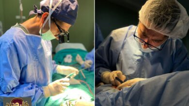 مصابي الحروق غزة: ندوب الحرب تستعصي على الشفاء بعد توقف العمليات