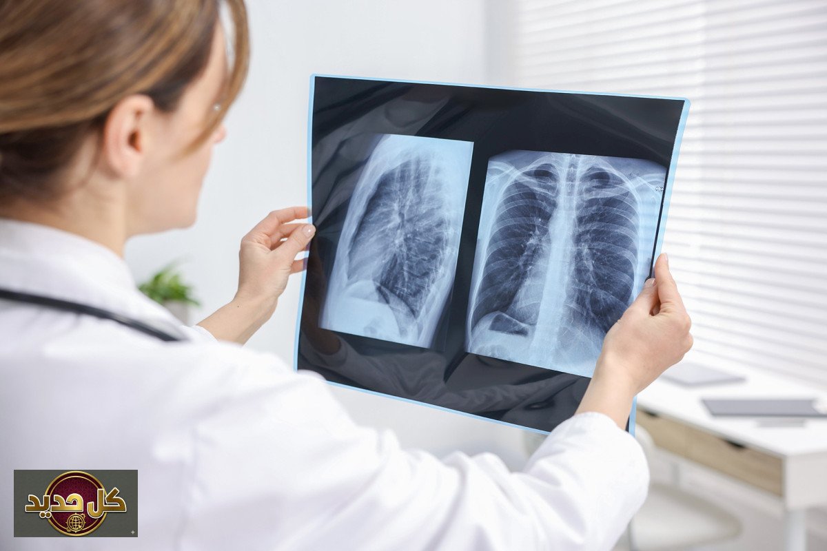 أمراض الرئة والنساء: لماذا تزداد خطورتها على الإناث؟