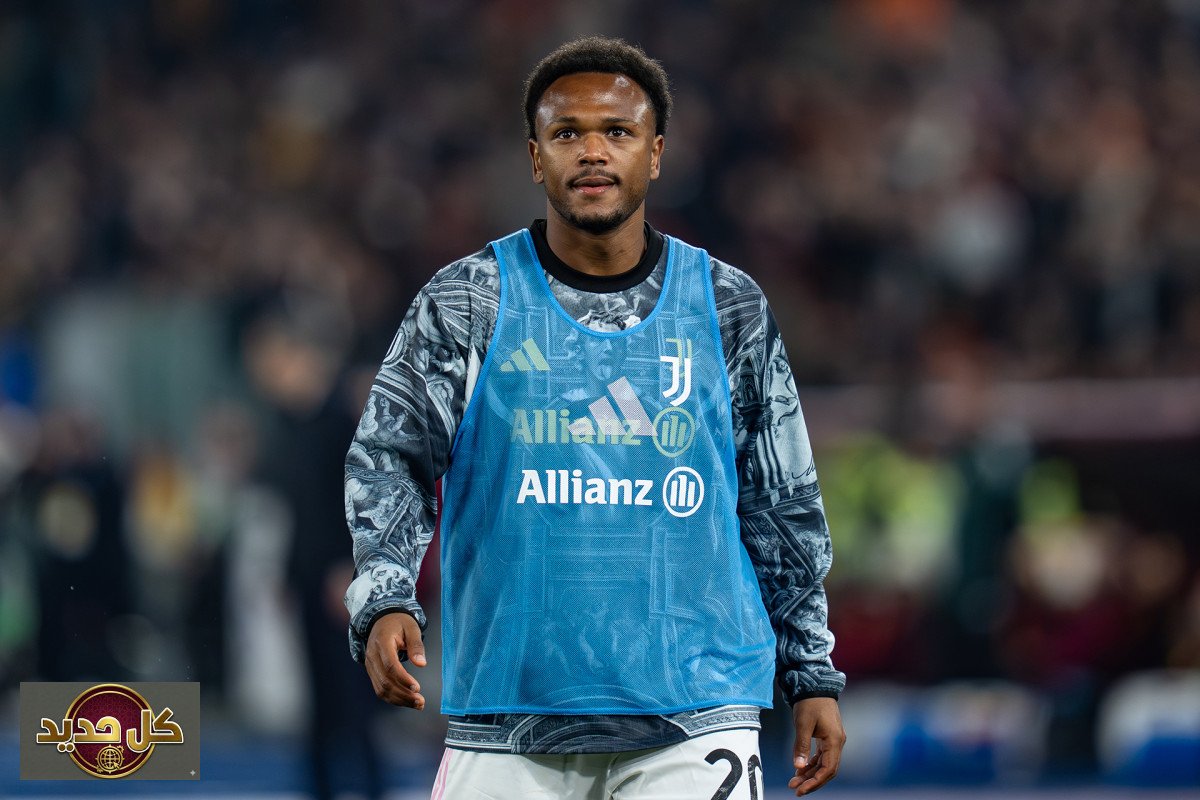 حجامة أوبيندا: لاعب يوفنتوس يشعل الجدل في الأوساط الرياضية الإيطالية