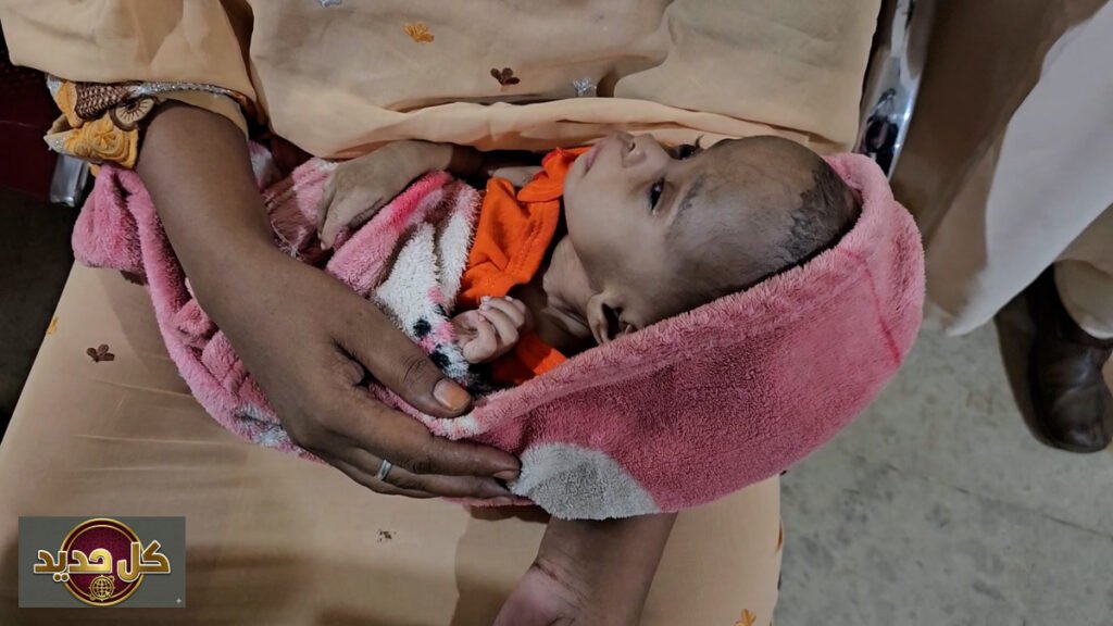 مساعدات طبية السودان: مخيمات جراحية مجانية تنقذ أطفال أم درمان