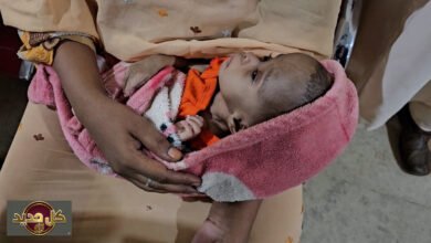 مساعدات طبية السودان: مخيمات جراحية مجانية تنقذ أطفال أم درمان