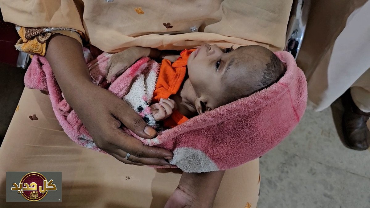 مساعدات طبية السودان: مخيمات جراحية مجانية تنقذ أطفال أم درمان