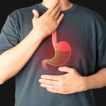 مريء باريت: الوجه الخفي لتحوله القاتل إلى سرطان المريء