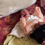 أطفال غزة: جيل يواجه فقر الدم والقروح وسط حصار قاسٍ