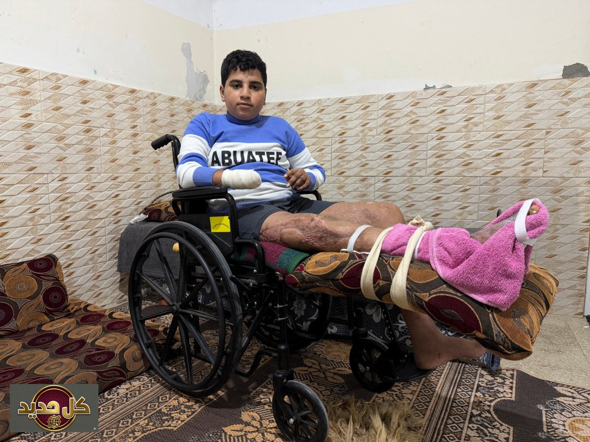 الألغام في غزة: 20 ألف قنبلة غير منفجرة تهدد حياة السكان في اليوم العالمي للتوعية