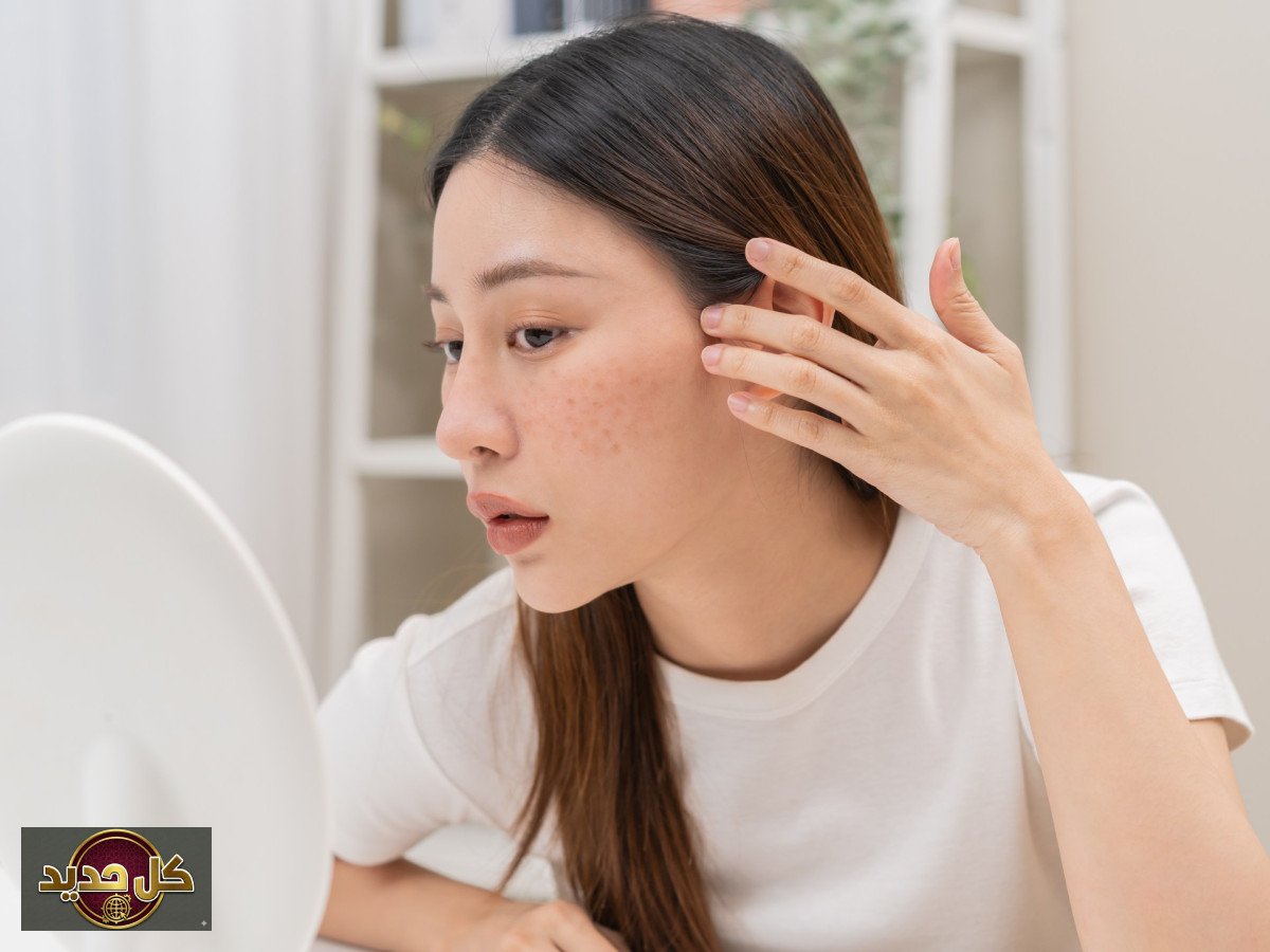 أطعمة لتنظيم الميلانين: وداعاً للبقع الداكنة ببشرة موحدة ومشرقة