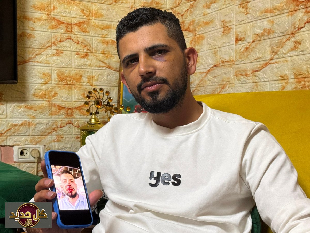 اعتداء عنصري يستهدف سائقًا مقدسيًا في تل أبيب: تفاصيل الحادث وتداعياته