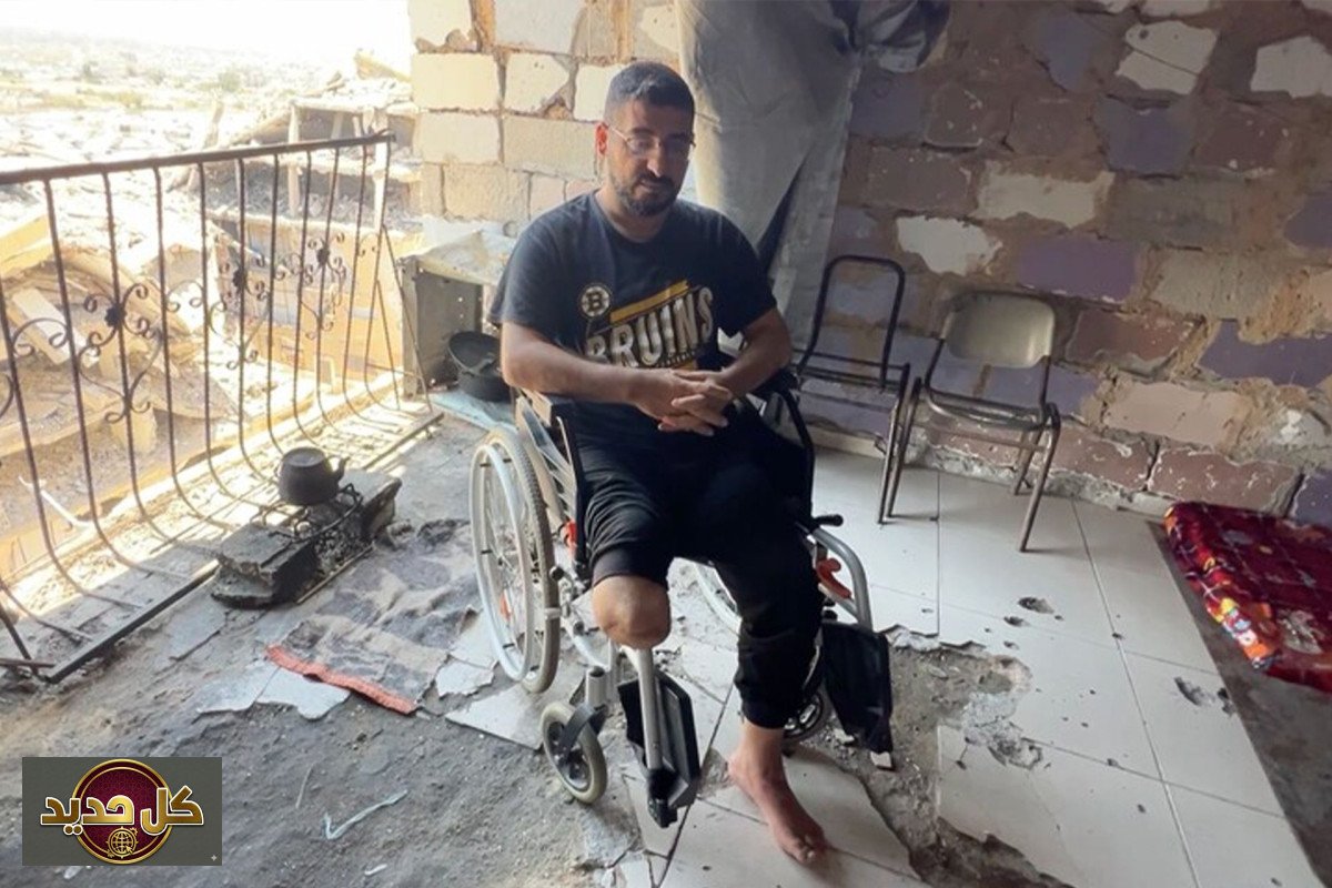 معاناة أسير فلسطيني: نجاة بلا ساق وفقدان وحيد في غزة