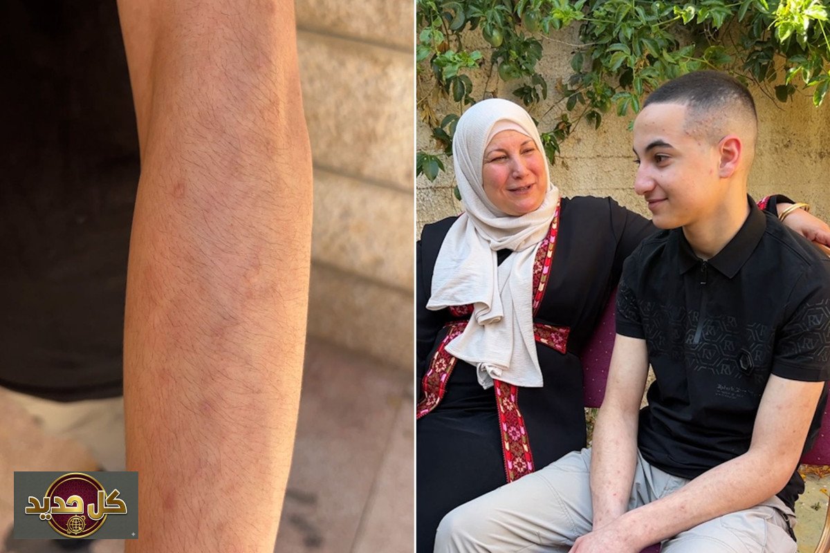 صدمة وراء القضبان: شهادة فتى تكشف انتهاكات أطفال الأسرى الفلسطينيين