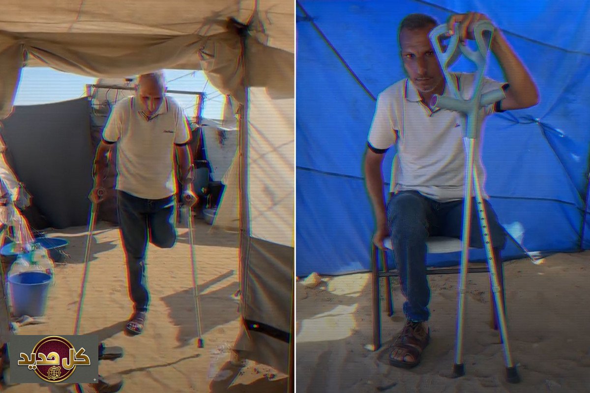 بتر ساق أسير فلسطيني: إهمال طبي مروع في السجون الإسرائيلية