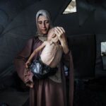 سوء التغذية: فهم شامل للأسباب، الأعراض، وطرق التدخل الفعالة