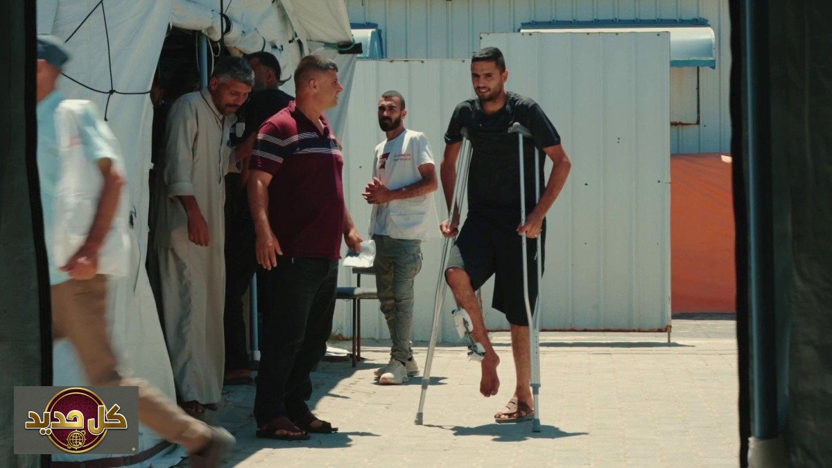 الجبائر البلاستيكية غزة: ابتكار طبي ينقذ الأطراف من البتر