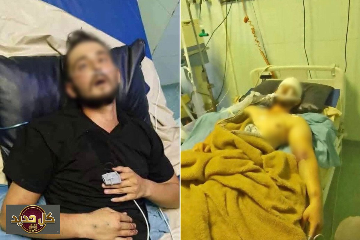 تحقيق وفاة شاب اللاذقية: لجنة وزارية تكشف ملابسات الحادث
